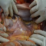 Autopsy of stabbed girl