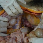 Autopsy of stabbed girl