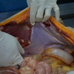 Autopsy of stabbed girl