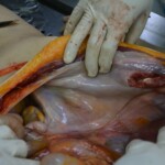 Autopsy of stabbed girl