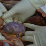 Autopsy of stabbed girl