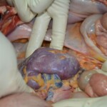 Autopsy of stabbed girl