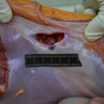 Autopsy of stabbed girl