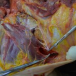 Autopsy of stabbed girl