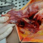 Autopsy of stabbed girl