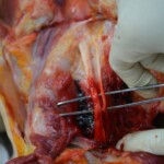 Autopsy of stabbed girl