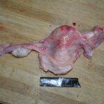 Autopsy of stabbed girl