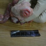 Autopsy of stabbed girl