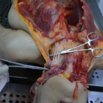 Autopsy of stabbed girl