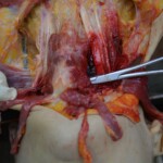 Autopsy of stabbed girl