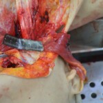 Autopsy of stabbed girl