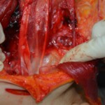 Autopsy of stabbed girl