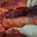 Autopsy of stabbed girl