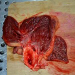 Autopsy of stabbed girl