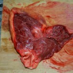 Autopsy of stabbed girl