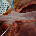 Autopsy of stabbed girl