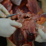 Autopsy of stabbed girl