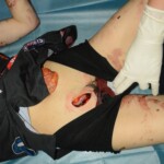 Stabbed teenage girl