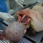 Autopsy of stabbed girl