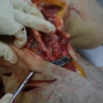 Autopsy of stabbed girl