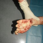 Stabbed teenage girl