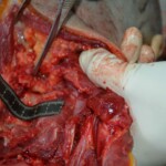 Autopsy of stabbed girl