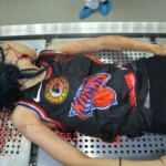 Autopsy of stabbed girl