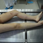Autopsy of stabbed girl