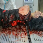 Autopsy of stabbed girl