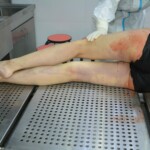 Autopsy of stabbed girl