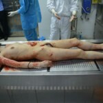 Autopsy of stabbed girl