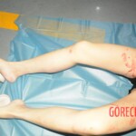 Stabbed teenage girl