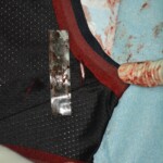 Autopsy of stabbed girl