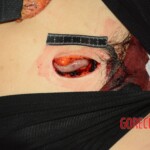 Stabbed teenage girl