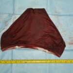 Autopsy of stabbed girl