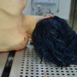 Autopsy of stabbed girl