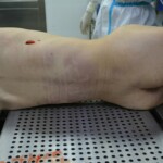 Autopsy of stabbed girl