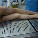 Autopsy of stabbed girl