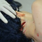 Autopsy of stabbed girl