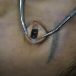 Autopsy of stabbed girl