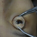 Autopsy of stabbed girl