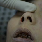 Autopsy of stabbed girl