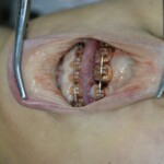 Autopsy of stabbed girl