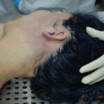 Autopsy of stabbed girl