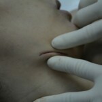 Autopsy of stabbed girl