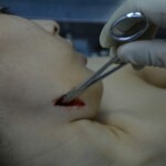 Autopsy of stabbed girl