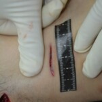 Autopsy of stabbed girl