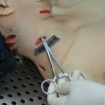 Autopsy of stabbed girl