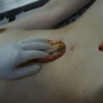 Autopsy of stabbed girl