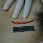 Autopsy of stabbed girl